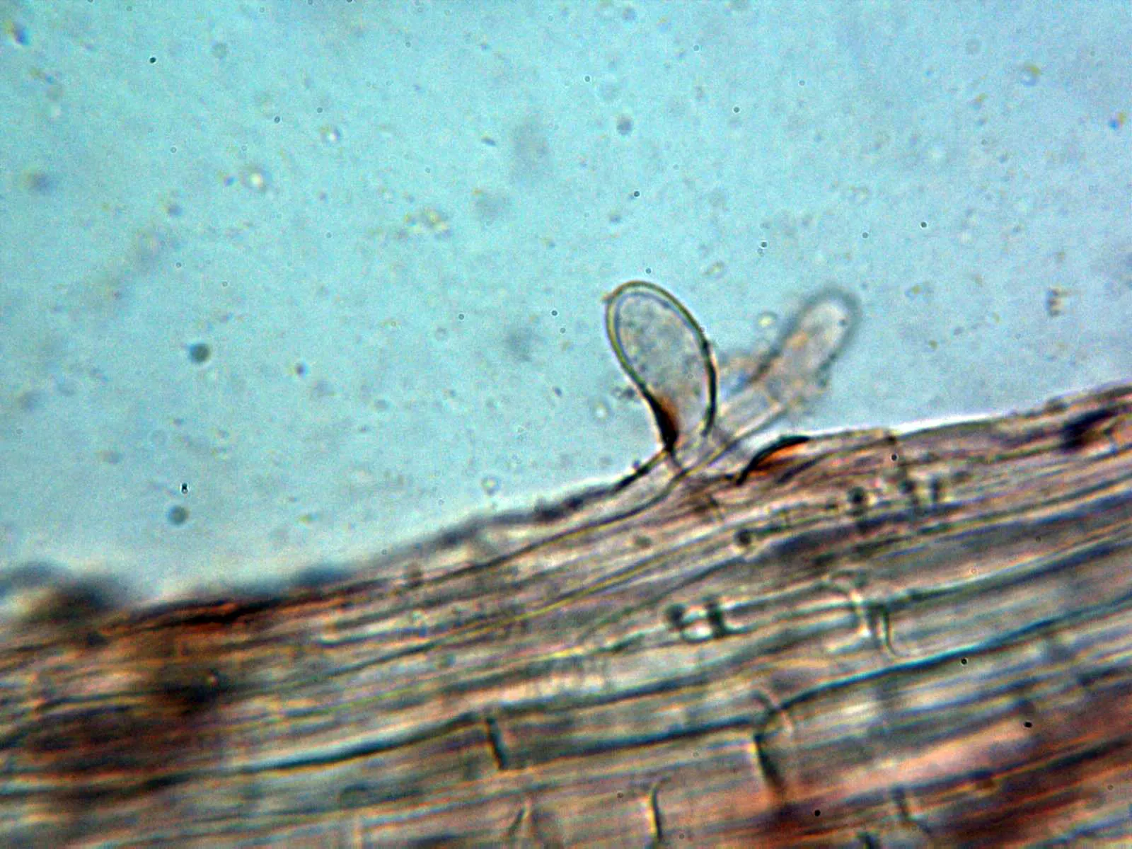 Microscopía de Rhodophana nitellina - 10 - Pequeño caulocistidio